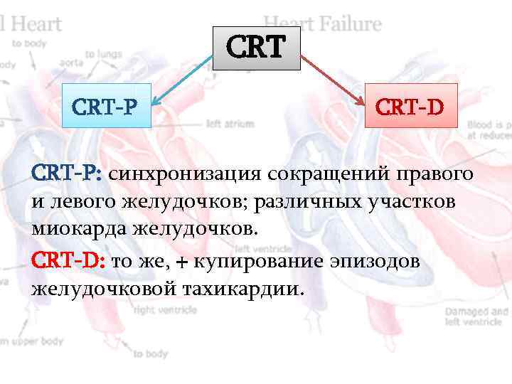 CRT CRT-P CRT-D CRT-P: синхронизация сокращений правого и левого желудочков; различных участков миокарда желудочков.