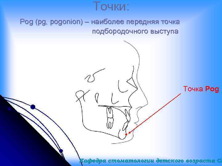 Точки: Pog (pg, pogonion) – наиболее передняя точка подбородочного выступа Точка Pog Кафедра стоматологии