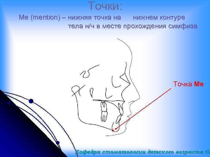 Точка me. Точка sna на ТРГ. Угол sna на ТРГ. Точка sna в ортодонтии. Точка GNATION.