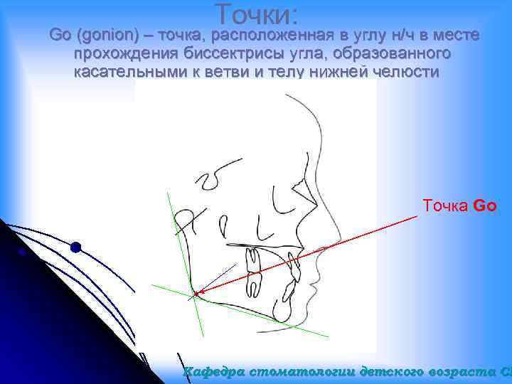 Точка угла. Точка гонион на ТРГ. Углы в ортодонтии. ТРГ углы. Углы ТРГ ортодонтия.