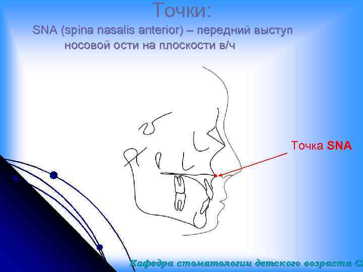 Точки: SNA (spina nasalis anterior) – передний выступ носовой ости на плоскости в/ч Точка