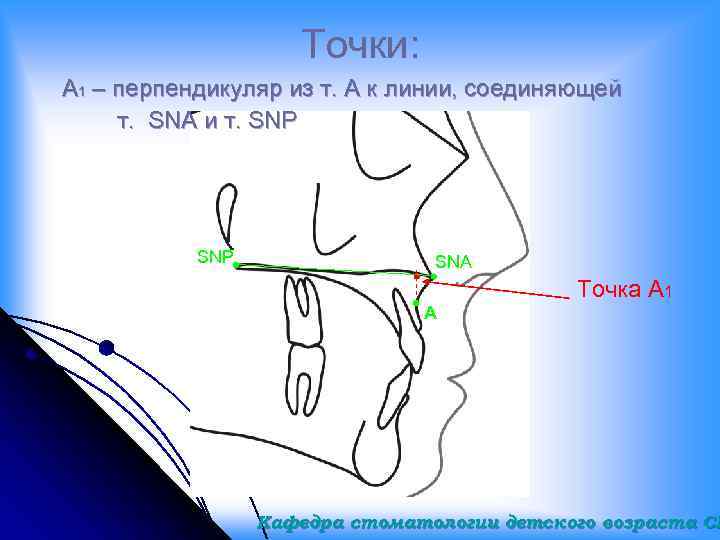 Точки: A 1 – перпендикуляр из т. А к линии, соединяющей т. SNA и