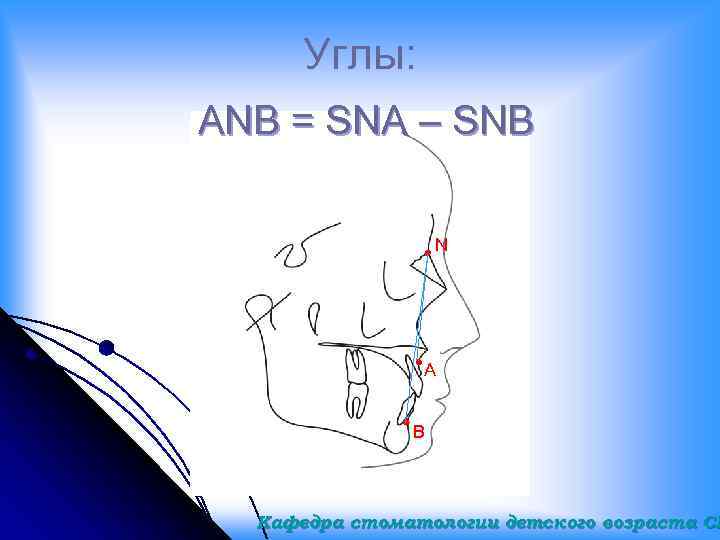 Углы: ANB = SNA – SNB N A B Кафедра стоматологии детского возраста СГ