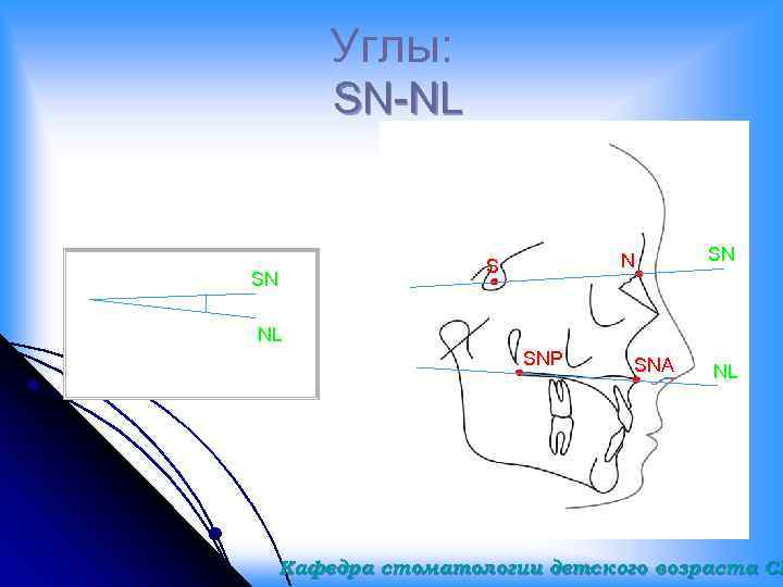 Углы: SN-NL SN N S SN NL SNP SNA NL Кафедра стоматологии детского возраста