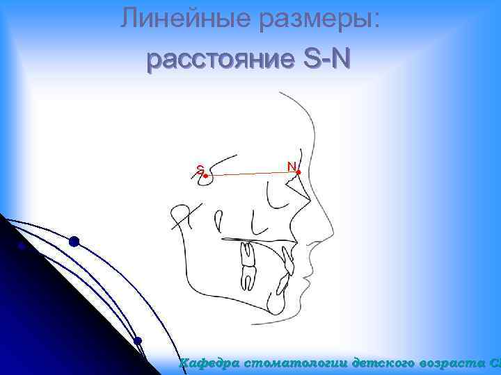 Линейные размеры: расстояние S-N S N Кафедра стоматологии детского возраста СГ 