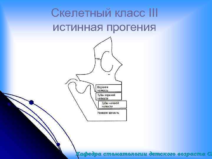 Скелетный класс III истинная прогения Кафедра стоматологии детского возраста СГ 