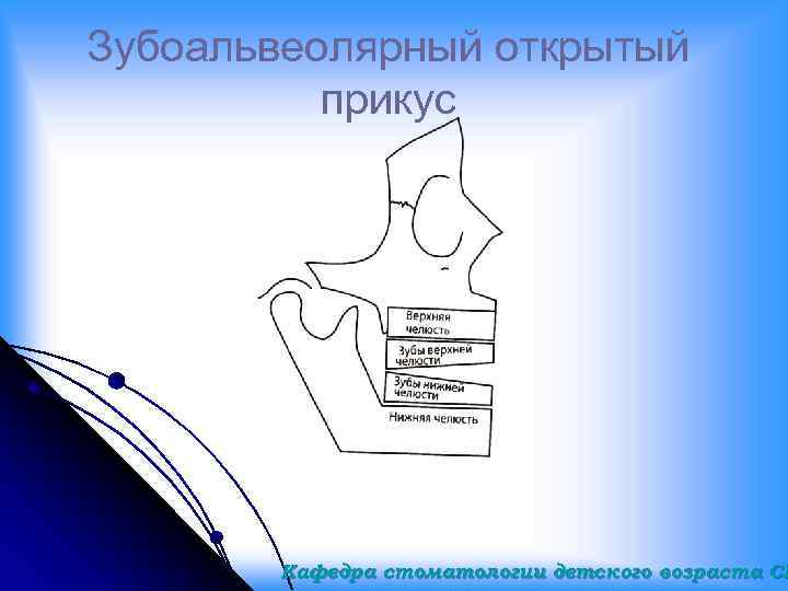 Зубоальвеолярный открытый прикус Кафедра стоматологии детского возраста СГ 