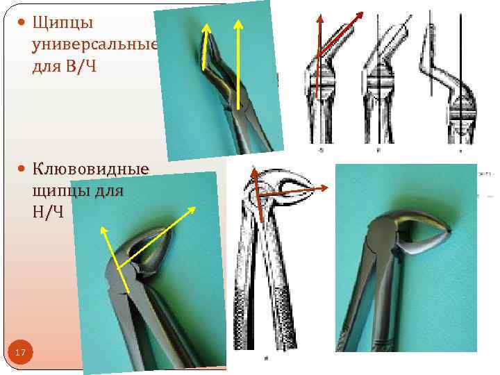  Щипцы универсальные для В/Ч Клювовидные щипцы для Н/Ч 17 