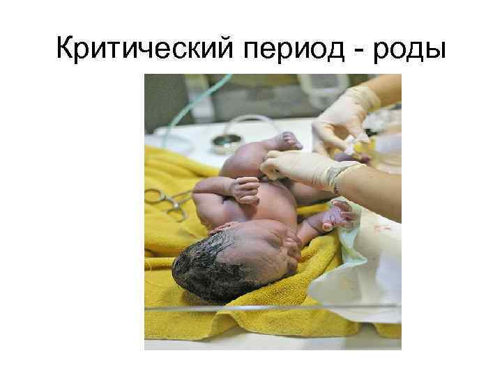 Критический период - роды 