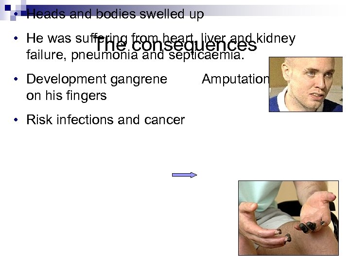  • Heads and bodies swelled up • He was suffering from heart, liver