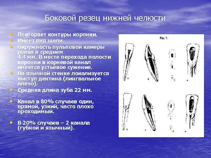 Боковой резец нижней челюсти • • • Повторяет контуры коронки. Имеет вид щели. Окружность