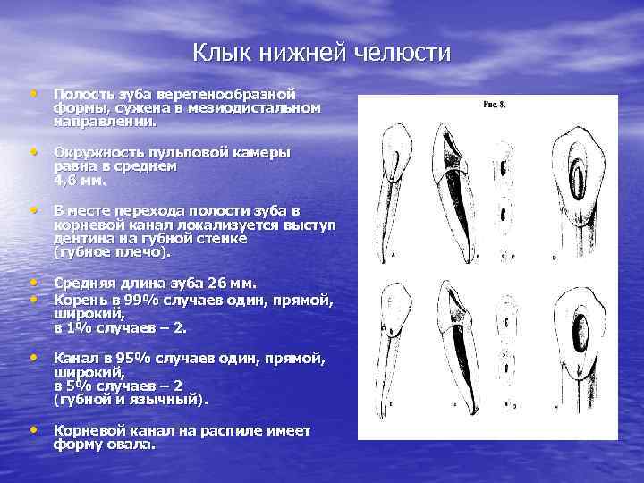 Клык нижней челюсти • Полость зуба веретенообразной формы, сужена в мезиодистальном направлении. • Окружность