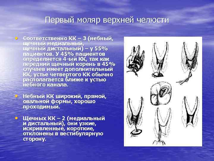 Первый моляр верхней челюсти • Соответственно КК – 3 (небный, щечный медиальный, щечный дистальный)