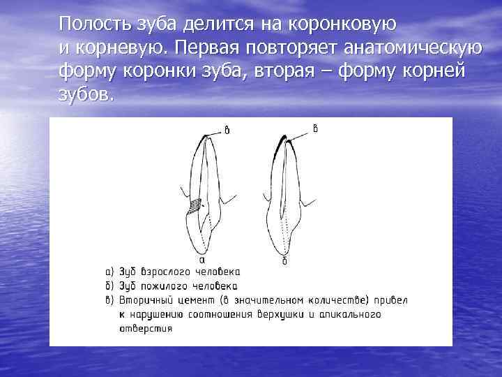 Полость зуба делится на коронковую и корневую. Первая повторяет анатомическую форму коронки зуба, вторая