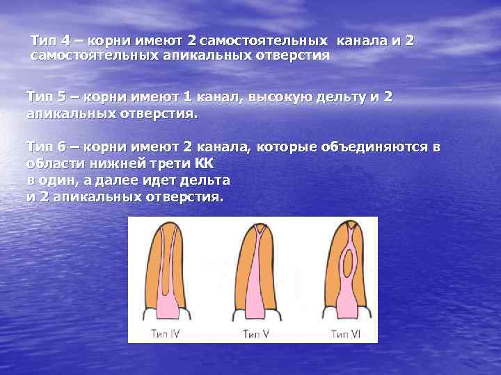 Тип 4 – корни имеют 2 самостоятельных канала и 2 самостоятельных апикальных отверстия Тип