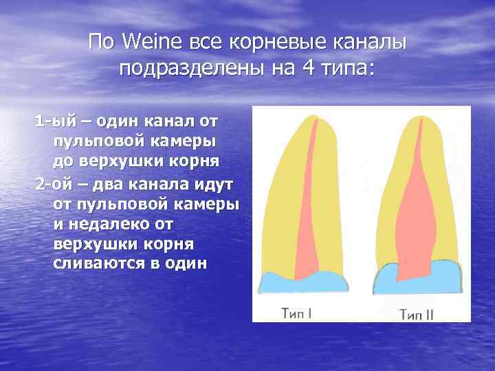 По Weine все корневые каналы подразделены на 4 типа: 1 -ый – один канал