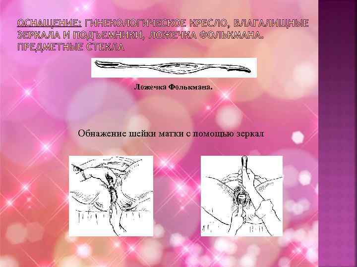 Ложечка Фолькмана. Обнажение шейки матки с помощью зеркал 