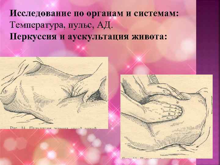 Исследование по органам и системам: Температура, пульс, АД. Перкуссия и аускультация живота: 