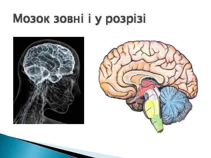 Мозок зовні і у розрізі 