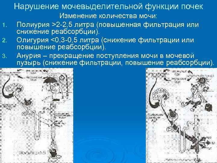 Нарушение мочевыделительной функции почек 1. 2. 3. Изменение количества мочи: Полиурия >2 -2, 5