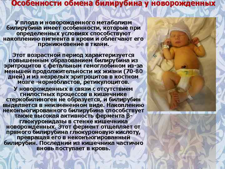Особенности обмена билирубина у новорожденных У плода и новорожденного метаболизм билирубина имеет особенности, которые