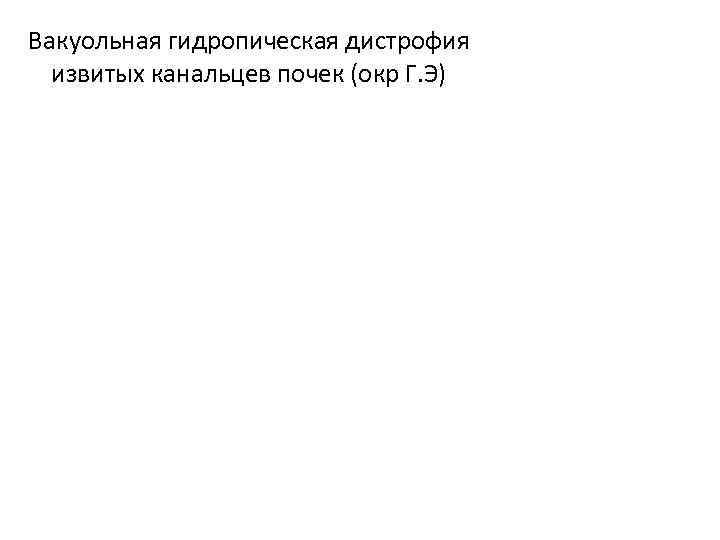 Вакуольная гидропическая дистрофия извитых канальцев почек (окр Г. Э) 