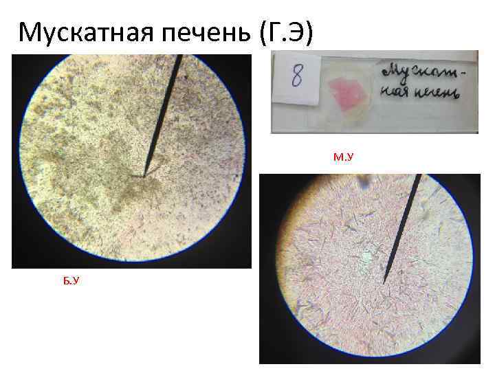 Мускатная печень (Г. Э) М. У Б. У 