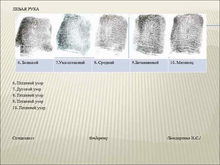 ЛЕВАЯ РУКА 6. Большой 7. Указательный 8. Средний 9. Безымянный 10. Мизинец 6. Петлевой