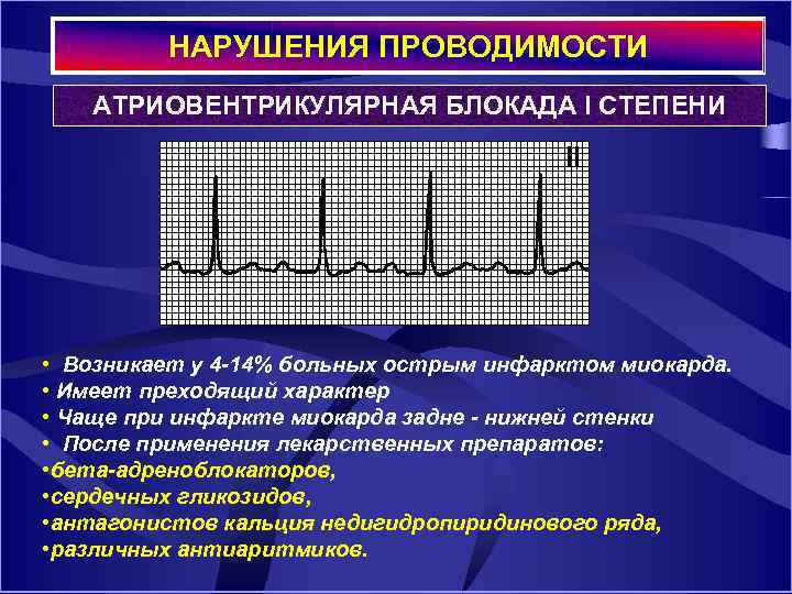 НАРУШЕНИЯ ПРОВОДИМОСТИ АТРИОВЕНТРИКУЛЯРНАЯ БЛОКАДА I СТЕПЕНИ • Возникает у 4 -14% больных острым инфарктом