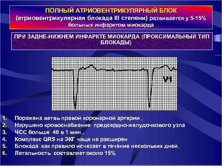 ПОЛНЫЙ АТРИОВЕНТРИКУЛЯРНЫЙ БЛОК (атриовентрикулярная блокада III степени) развивается у 5 15% больных инфарктом миокарда