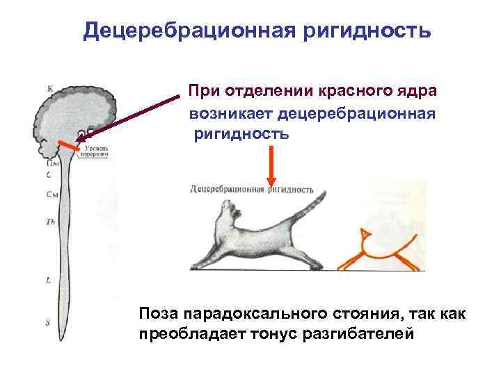 Пути флексига и говерса схема