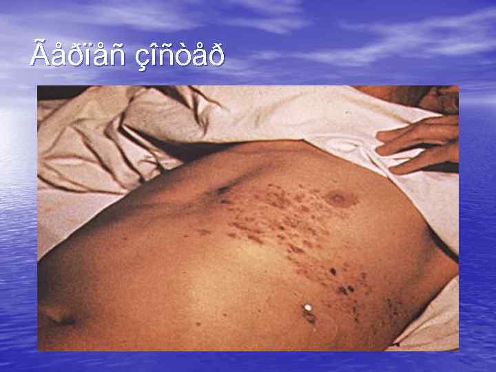 Ãåðïåñ çîñòåð 