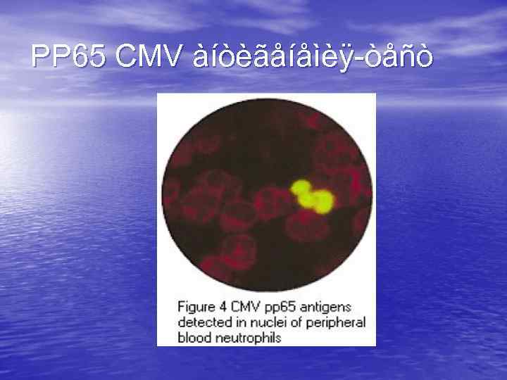 PP 65 CMV àíòèãåíåìèÿ-òåñò 