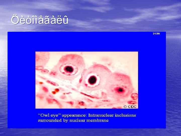 Öèòîìåãàëû 