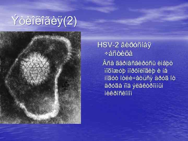 Ýòèîëîãèÿ(2) HSV-2 âèðóñíàÿ ÷àñòèöà ñå ãåðïåñâèðóñû èìåþò ïîõîæóþ ìîðôîëîãèþ è íå ìîãóò îòëè÷àòüñÿ äðóã