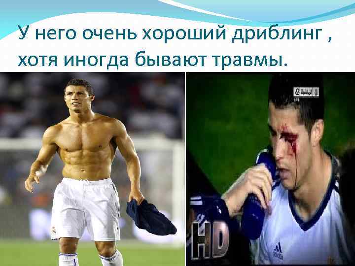 У него очень хороший дриблинг , хотя иногда бывают травмы. 