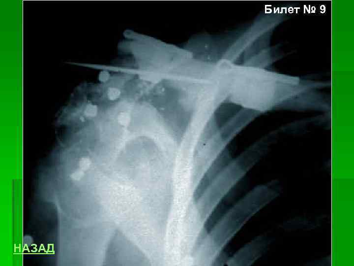 Билет № 9 НАЗАД 