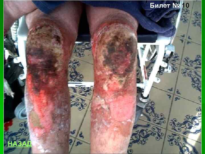 Билет № 10 НАЗАД 
