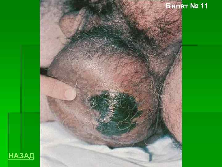 Билет № 11 НАЗАД 
