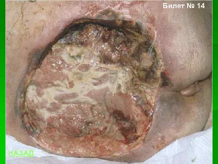 Билет № 14 НАЗАД 