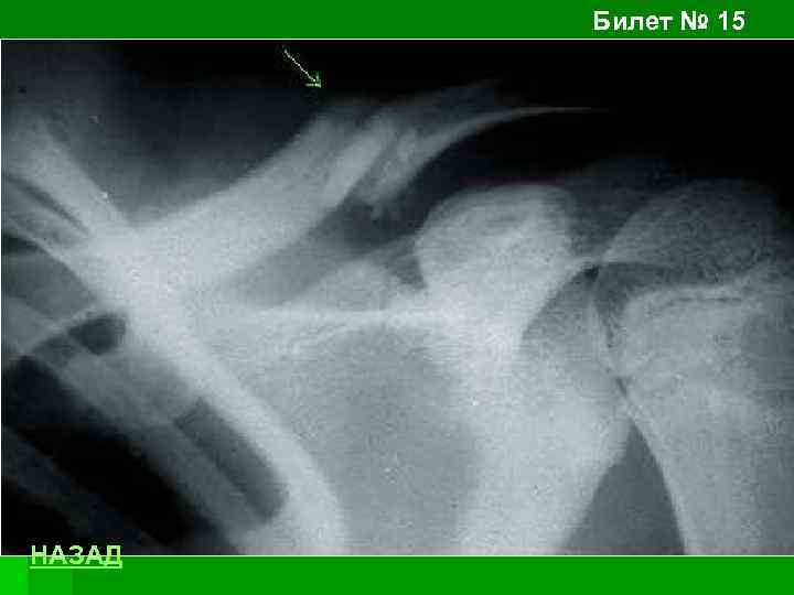 Билет № 15 НАЗАД 