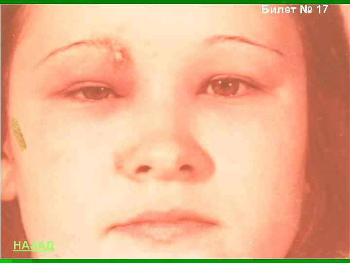 Билет № 17 НАЗАД 