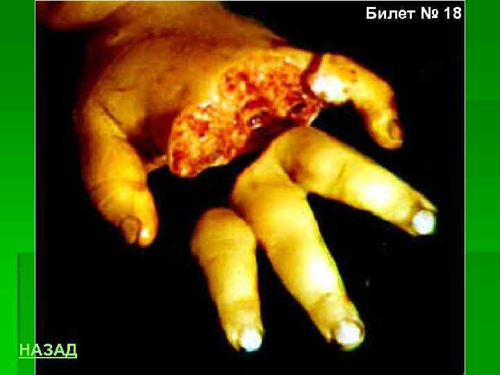 Билет № 18 НАЗАД 