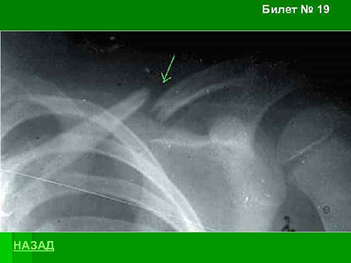 Билет № 19 НАЗАД 