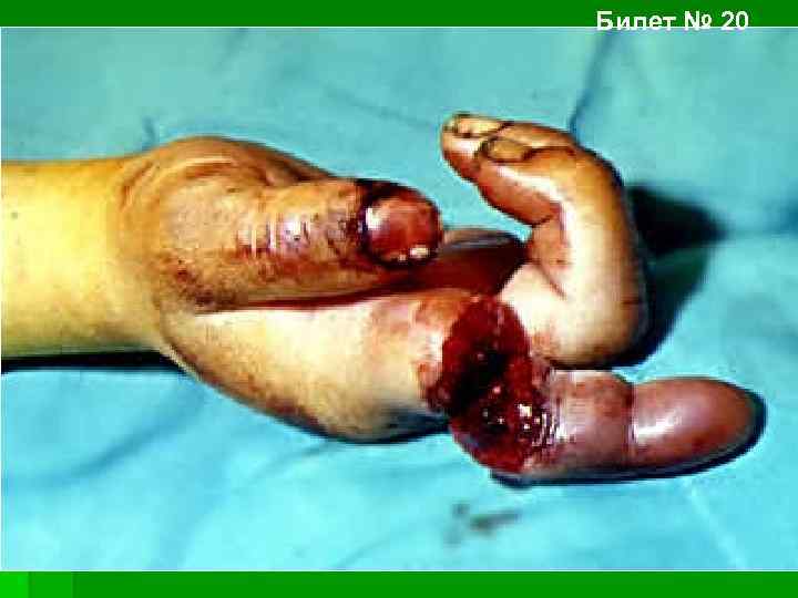 Билет № 20 