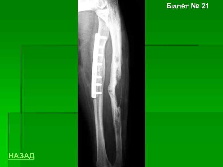 Билет № 21 НАЗАД 