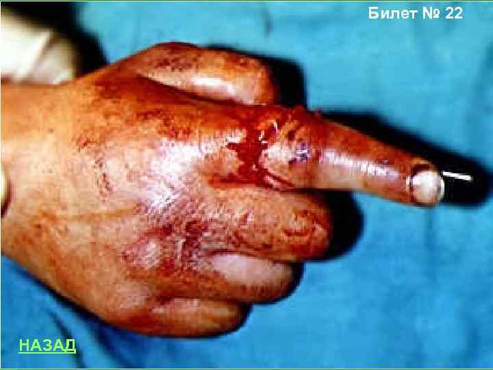 Билет № 22 НАЗАД 