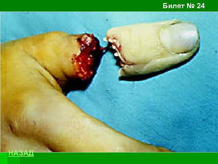 Билет № 24 НАЗАД 