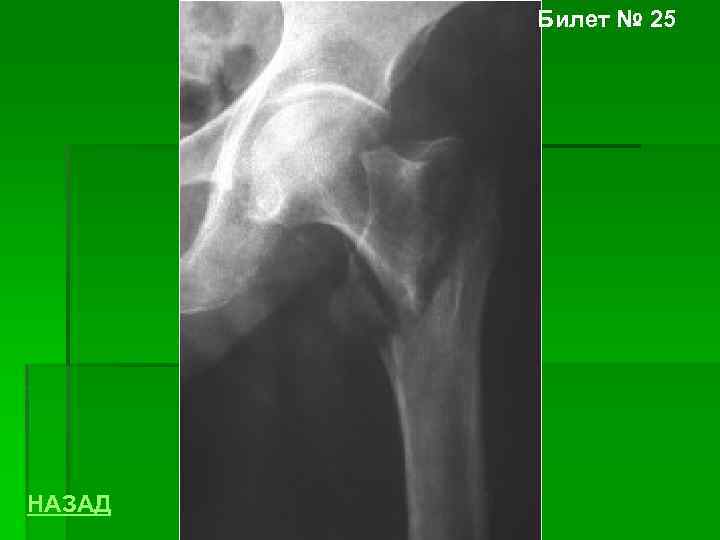 Билет № 25 НАЗАД 