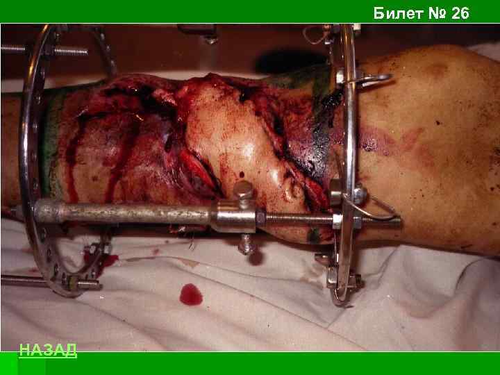 Билет № 26 НАЗАД 